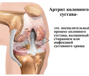 Солодка в медицине и косметологии