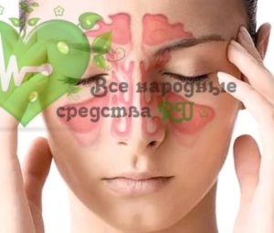 Гайморит: лечение народными средствами